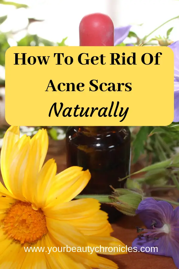 How To Get Rid of Acne Scars Naturally