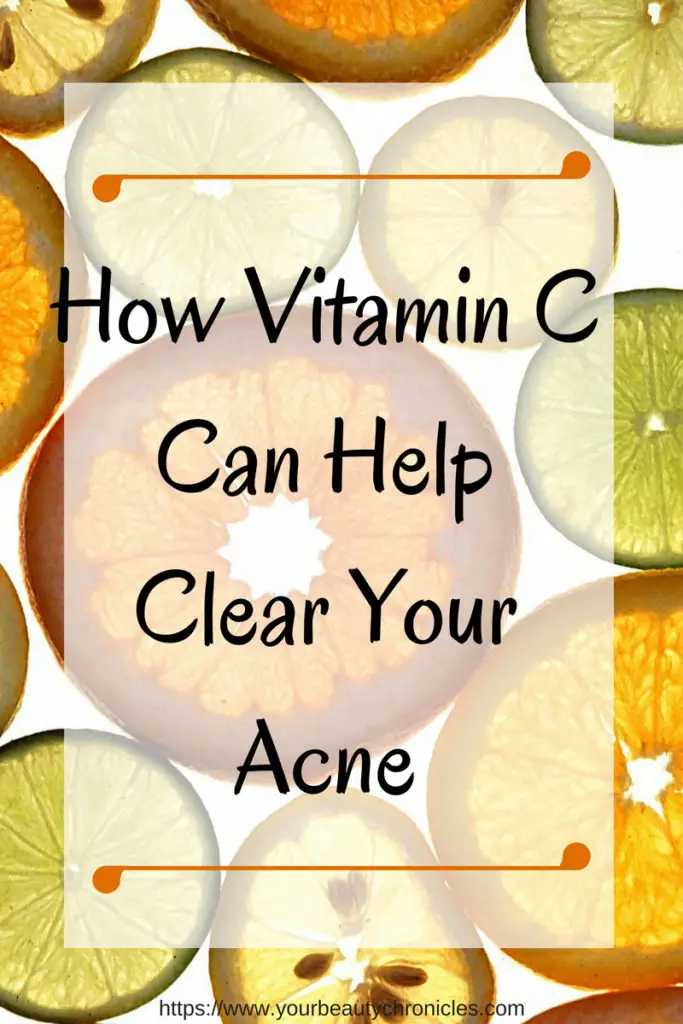 vitamin C for acne