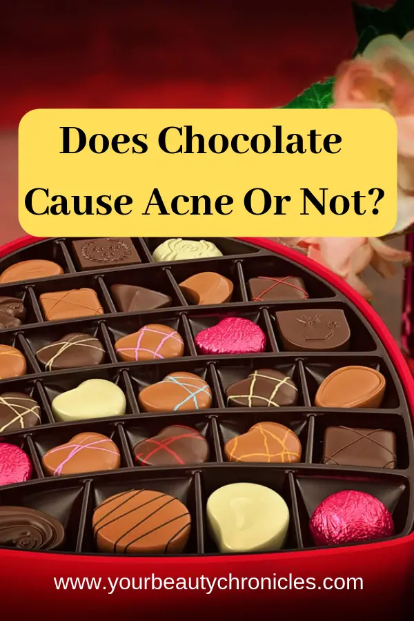 does chocolate cause acne