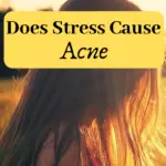 does stress cause acne