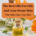 best oils for acne prone skin